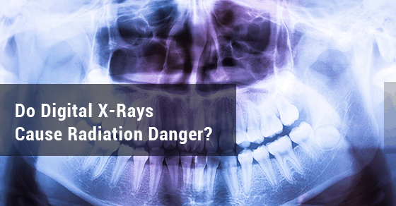 X Ray Radiation >> Is There Any Radiation Danger From Digital X Rays Sierra Dental X Ray Radiation >> Is There Any Radiation Danger From Digital X Rays Sierra Dental